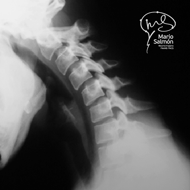 Radiografía Lateral Columna Cervical en Flexión Normal