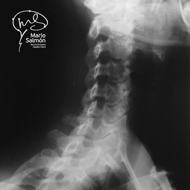 Oblique right Normal X-ray